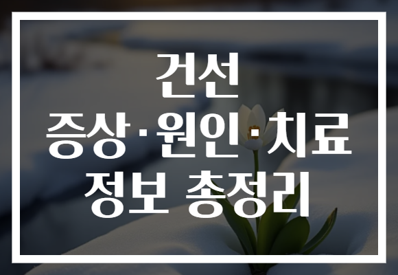 건선 증상·원인·치료 정보 총정리 건선 증상·원인·치료 정보 총정리