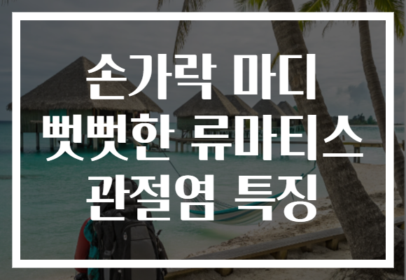 손가락 마디 뻣뻣한 류마티스 관절염 특징 손가락 마디 뻣뻣한 류마티스 관절염 특징