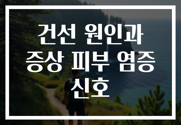 건선 원인과 증상 피부 염증 신호